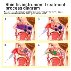 kf-Sbd884595574f47d684e50cfdec822a4dt-M-quina-de-terapia-para-curar-la-rinitis-Sinusitis-Dispositivo-de-masaje-BioNase-para-el-cuidado